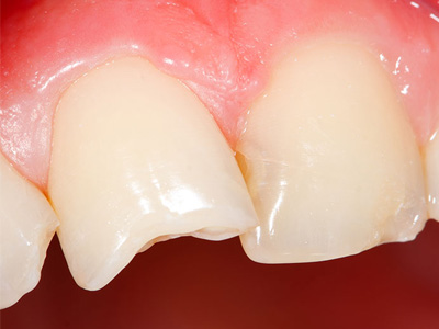 An image of a close-up view of a human mouth with visible teeth and gums, showcasing dental health.