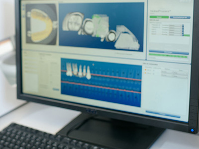 A computer monitor displaying medical imaging, with a keyboard and mouse in front of it on a desk.