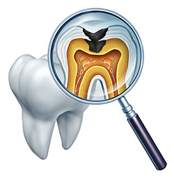 The image shows a magnified view of a human tooth with an open crown, through which a microscopic view of the interior is visible. A small fish-like creature is inside the tooth s pulp chamber, surrounded by the tooth s root canals and nerves. The image has been stylized to emphasize the unusual content.